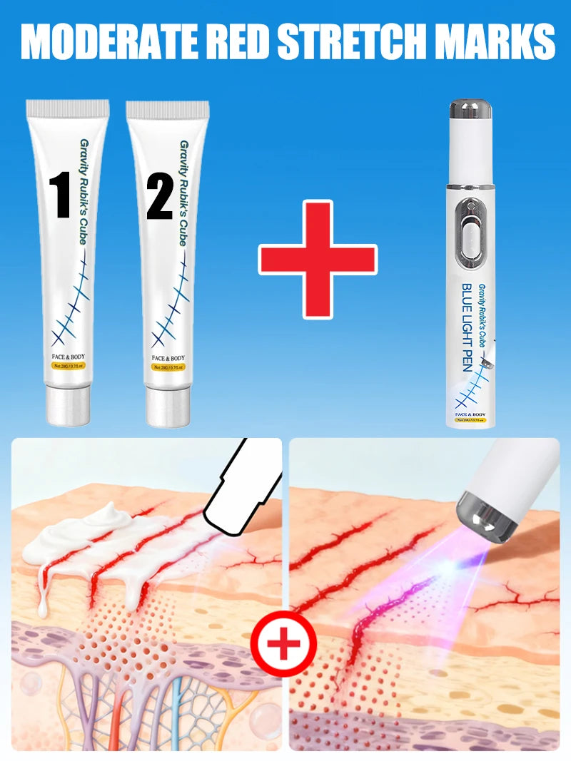 Striae Laser Device Eliminate Body Stretch Marks Products