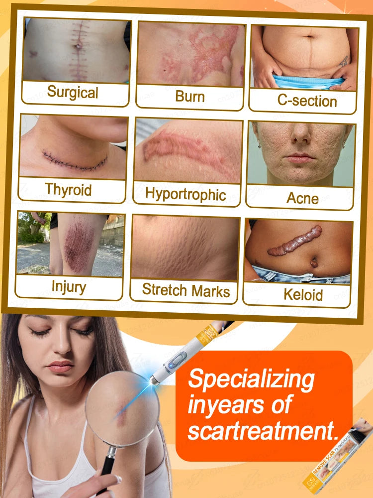 Want to get rid of scars, try this