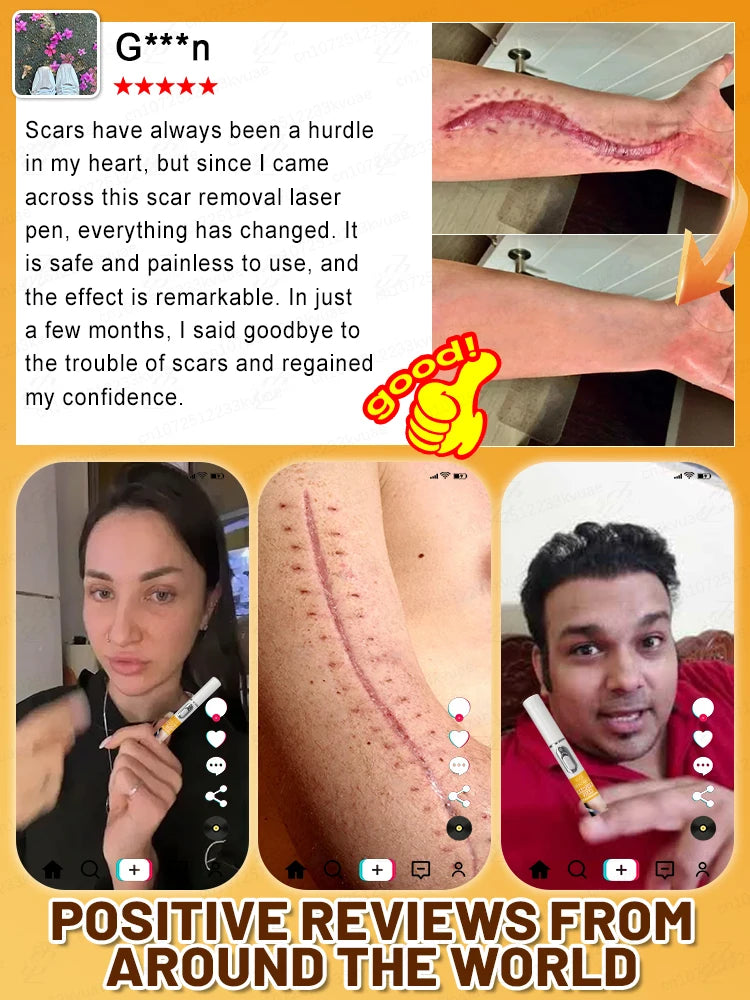 Want to get rid of scars, try this