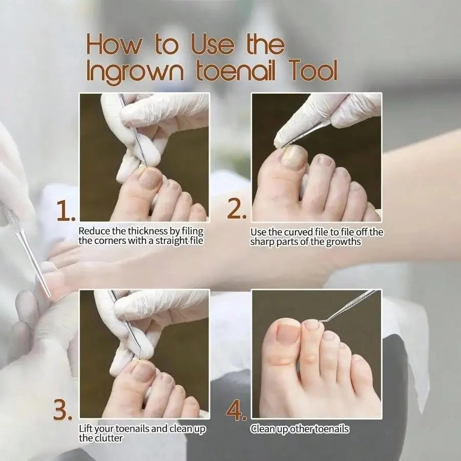 3pcs Nail Stain Removal Tool, Multifunctional Nail File, Pedicure Tool Beauty File,  Toenail Tool Pedicure Nail Cleaner