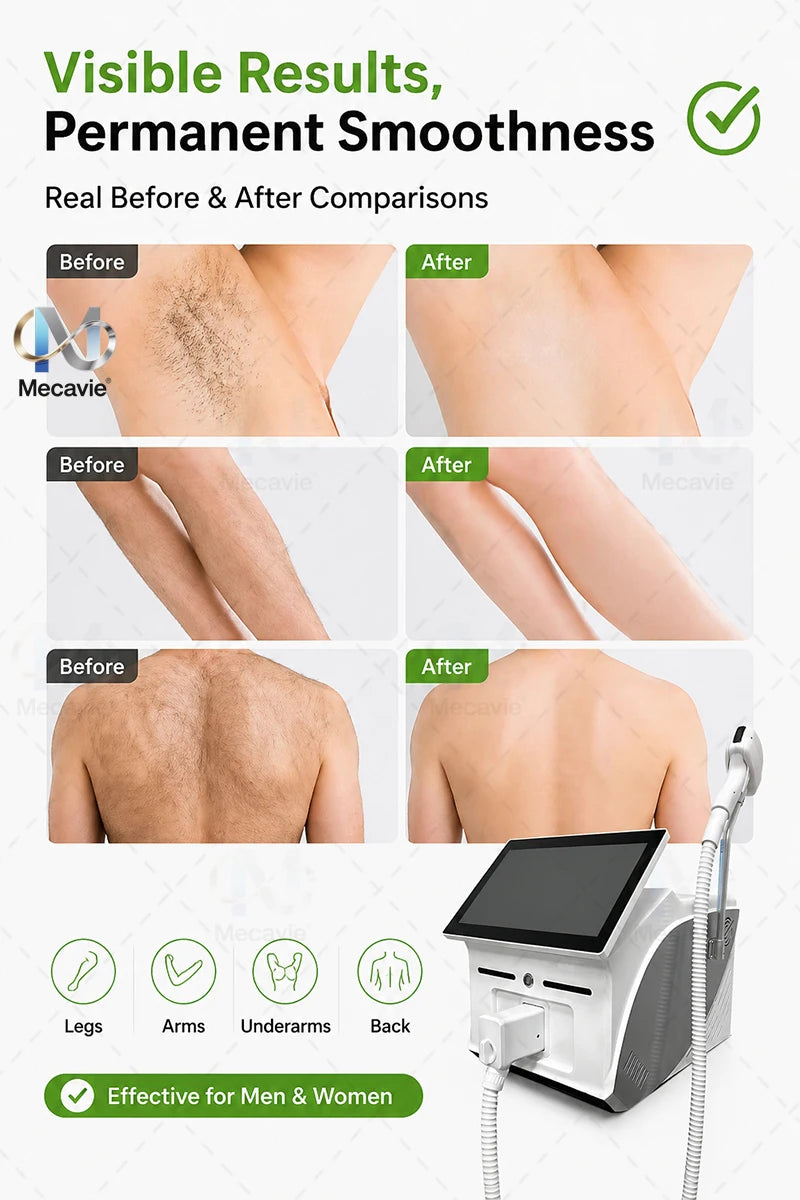 Latest 5000W Diode Laser painless permanent hair removal FAC advanced technology with 4 Waves Salon Exclusive Full Certificate