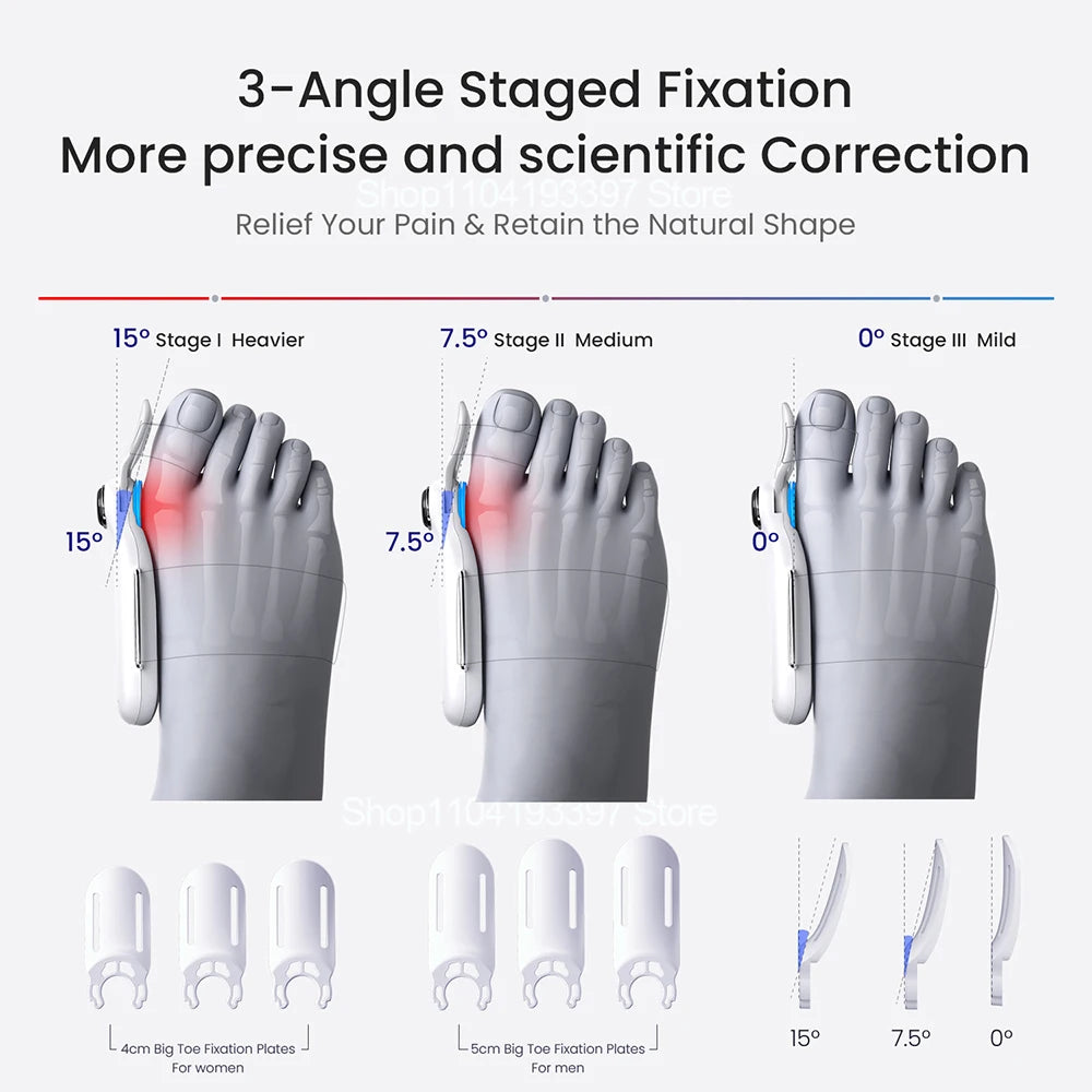 Electric Bunion Corrector Airbag traction vibration massage Foot Hallux Valgus Braces Toe Separator Straightener Toe Correction