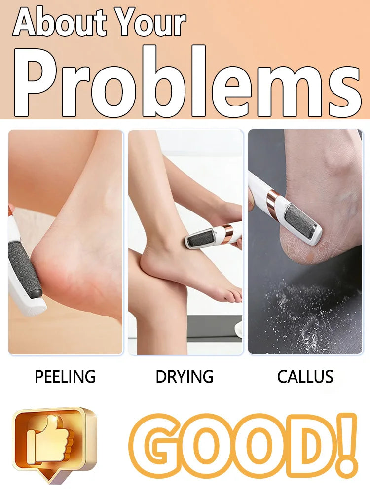 Automatic foot file, removes calluses, foot beauty device, callus remover, foot scrubber, foot care tool, unisex.