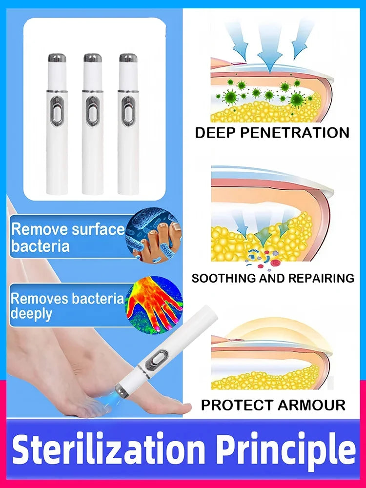 Fifth generation nail laser pen helps you say goodbye to onychomycosis. Technology changes your life.
