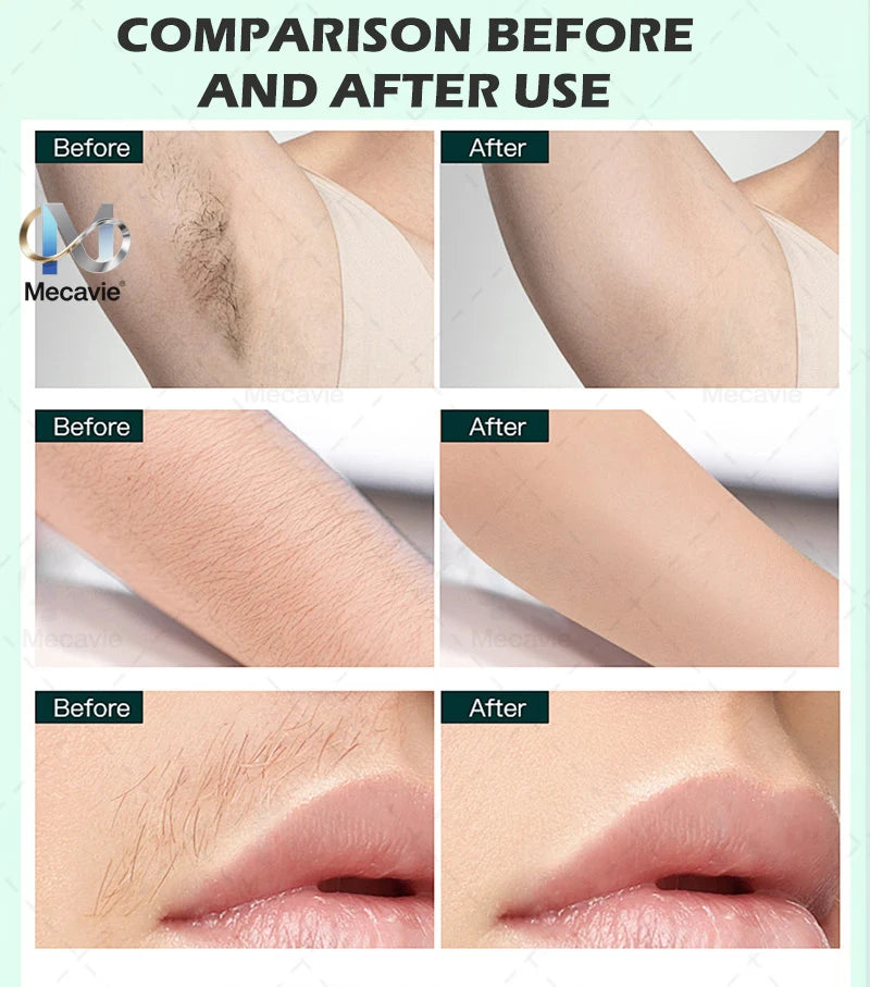 2026 Newest 2-in-1 Soprano 4000W 808nm Diode Laser Hair Removal Device 4-Wave Painless Permanent + Pico Tattoo Removal