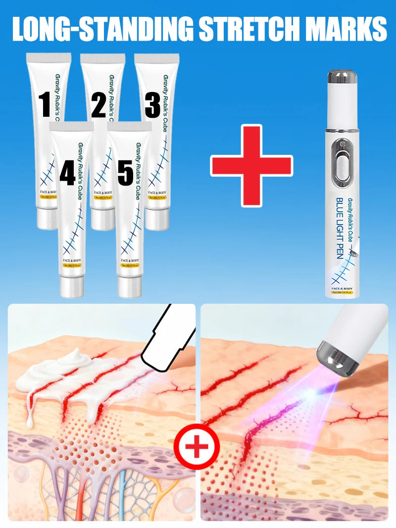 Striae Laser Device Eliminate Body Stretch Marks Products