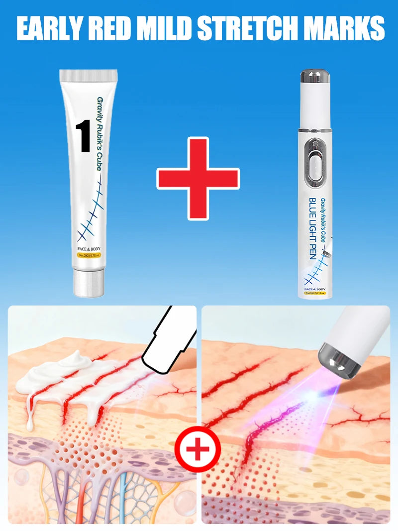 Striae Laser Device Eliminate Body Stretch Marks Products