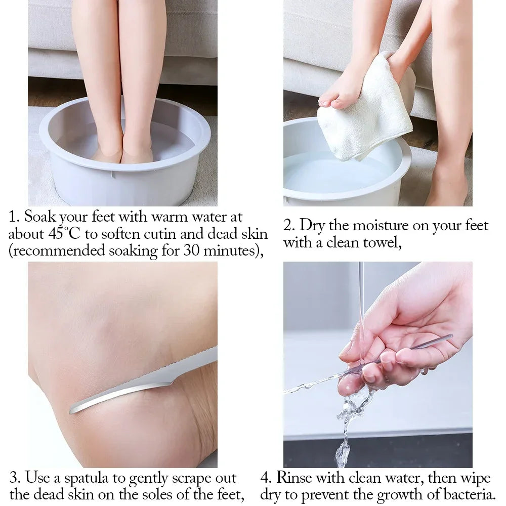 1/2/5/10pcs Manicure Pedicure Tools Toe Nail Shaver Feet Pedicure Knife Kit Foot Rasp File Dead Light Beige Remover Foot Care